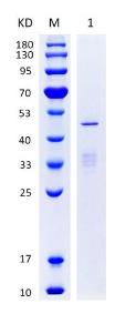 SDS-PAGE (DNM2-20H).jpg